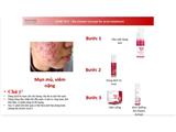 Tìm đại lý phân phối dược mỹ phẩm trị mụn cao cấp bulgary