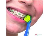  curaprox - lựa chọn hoàn hảo cho người niềng răng, implant,... sản phẩm được các chuyên gia, bác sĩ nha khoa tin và khuyên dùng 